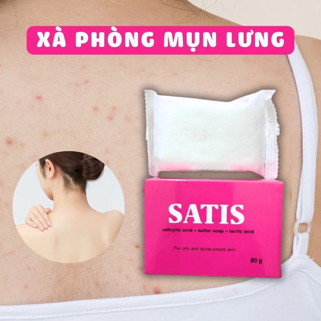 Xà Phòng SATIS 80g – Hỗ Trợ Giảm Mụn Lưng, Mụn Ngực, Làm Sạch Da, Tẩy Tế Bào Chết, Cho Da Dầu Mụn