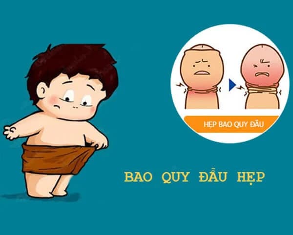 Hẹp bao quy đầu: Triệu chứng và nguyên tắc điều trị