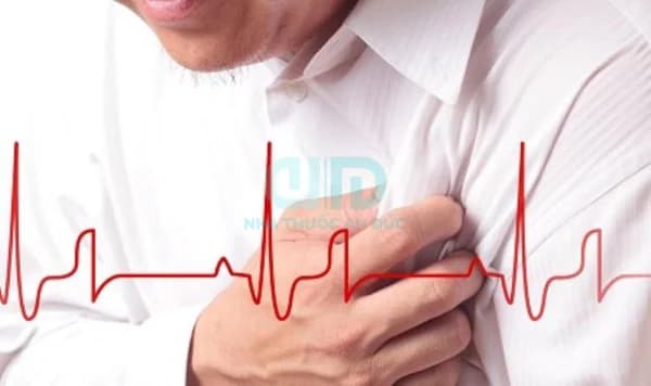 Thời gian vàng cấp cứu người nhồi máu cơ tim