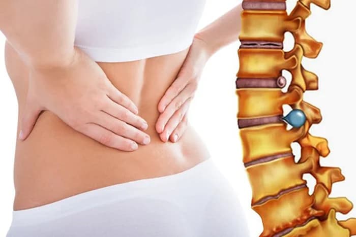 Thoái hóa đĩa đệm: Nguyên nhân, dấu hiệu và cách điều trị