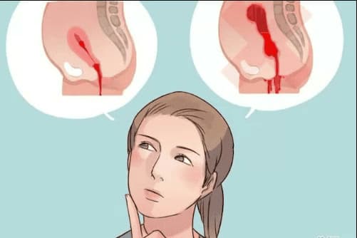 Băng huyết sau sinh: Dấu hiệu cảnh báo và cách xử trí khẩn cấp