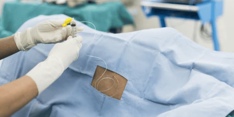 Bí tiểu ở sản phụ sau sinh: Nguyên nhân và cách phòng tránh
