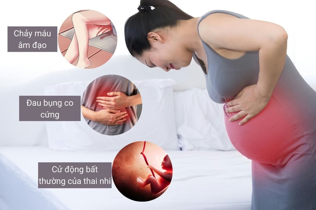 Sảy thai: Dấu hiệu nguyên nhân và cách xử trí