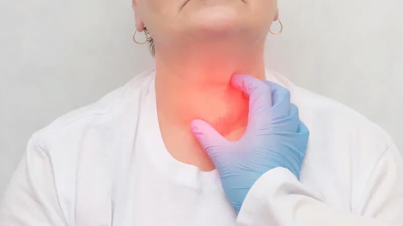 Bướu giáp keo: Nguyên nhân, triệu chứng và các phương pháp chẩn đoán