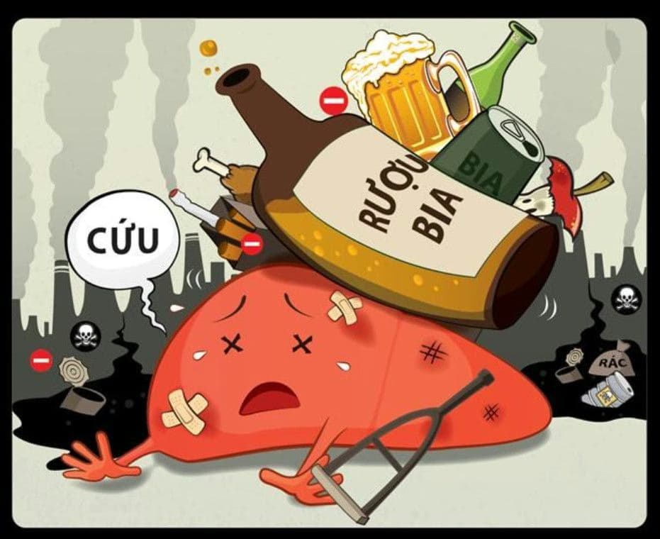 Xơ gan do rượu: Dấu hiệu, biến chứng nguy hiểm và cách điều trị