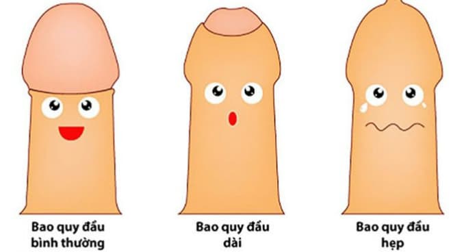 Hẹp bao quy đầu: Dấu hiệu, nguyên nhân và nguyên tắc điều trị