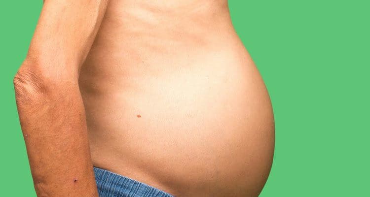 Cổ trướng: Nguyên nhân, triệu chứng và các phương pháp chẩn đoán