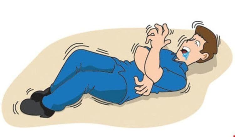 Co giật: Tổng quan bệnh học, nguyên nhân, triệu chứng và quy trình chẩn đoán