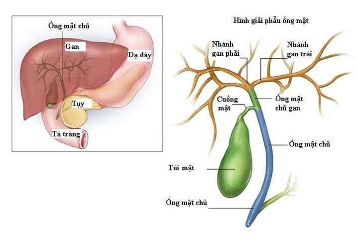 Thiếu máu cục bộ đường mật: Nguyên nhân, dấu hiệu và cách xử trí