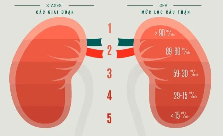 Suy thận giai đoạn cuối: Dấu hiệu, biến chứng và cách điều trị