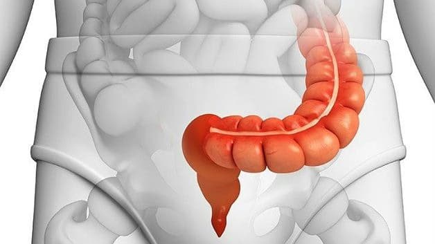 Viêm đại tràng sigma: Nguyên nhân, dấu hiệu và cách điều trị