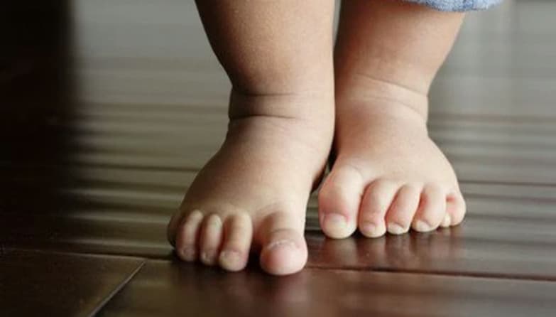 Bệnh xương Köhler ở trẻ em: Nguyên nhân, dấu hiệu và cách điều trị