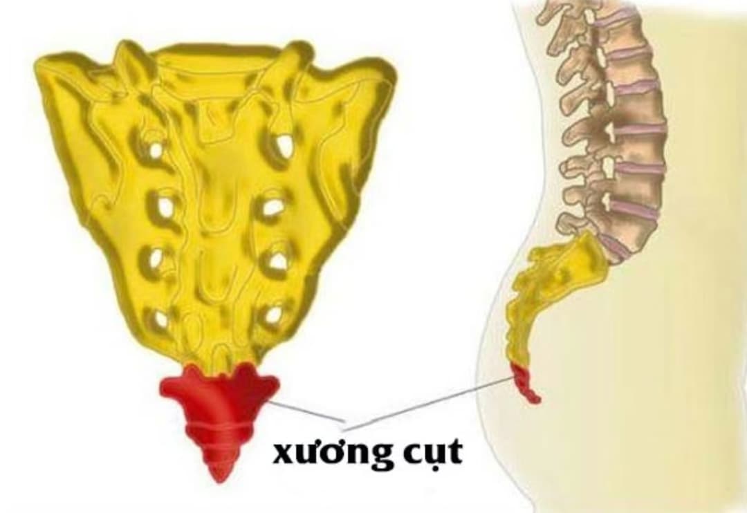 Đau xương cụt: Nguyên nhân, dấu hiệu và phương pháp chẩn đoán