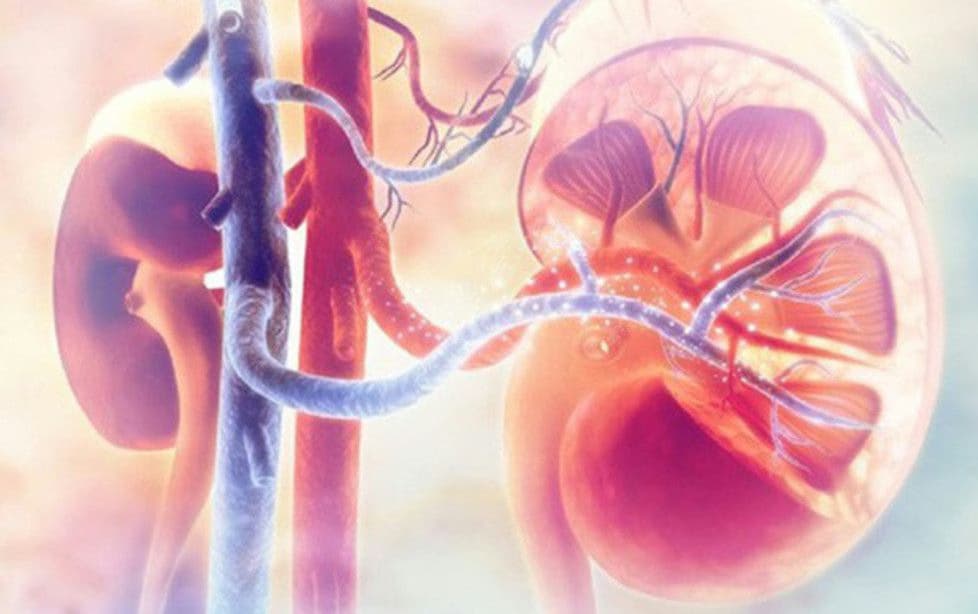 Viêm cầu thận tiến triển nhanh: Nguyên nhân, dấu hiệu và cách xử trí