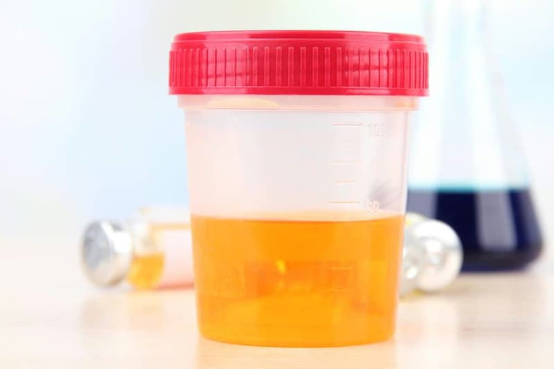 Viêm tuyến tiền liệt: Nguyên nhân, dấu hiệu và cách điều trị