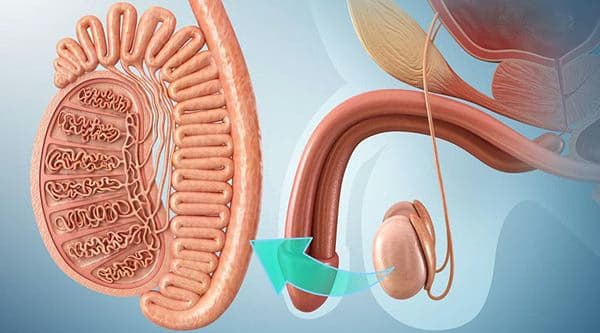 U tinh hoàn: Dấu hiệu, nguyên nhân và hướng thăm khám