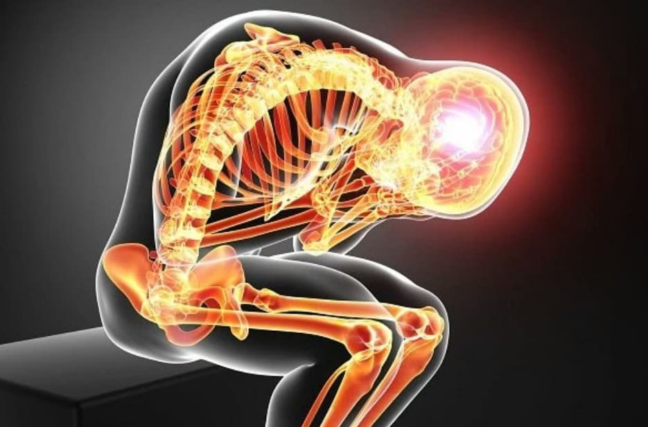 Rối loạn dạng cơ thể: Dấu hiệu và cách điều trị