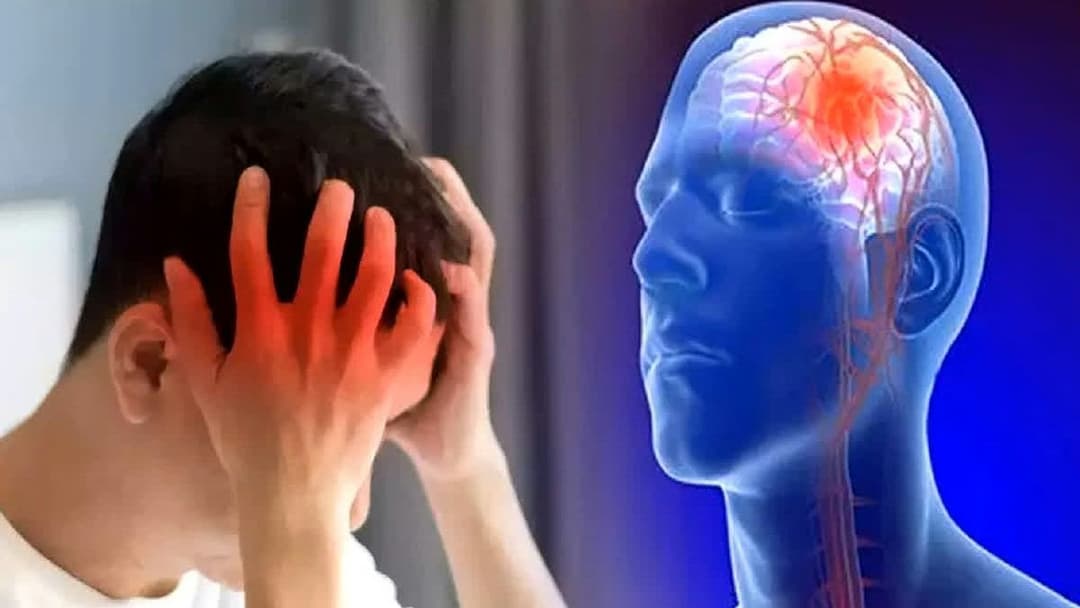 Đột quỵ não: Nguyên nhân, dấu hiệu và chẩn đoán