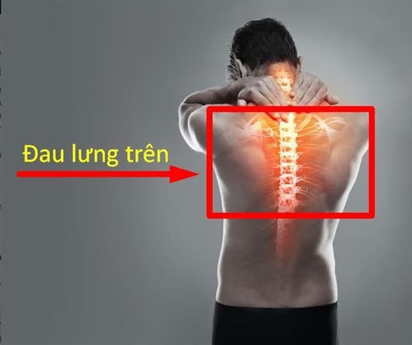 Đau lưng trên: Nguyên nhân, triệu chứng và cách xử trí