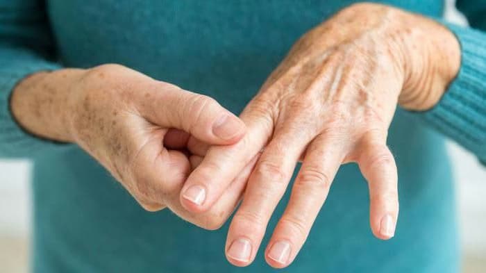 Tê bì chân tay: Nguyên nhân, dấu hiệu và cách điều trị