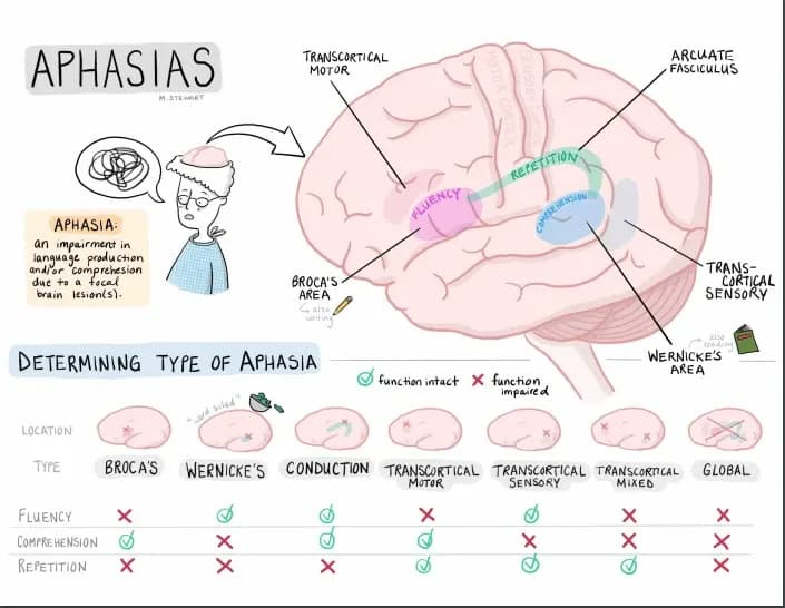 Chứng mất ngôn ngữ (Aphasia): Nguyên nhân, triệu chứng và phương pháp chẩn đoán