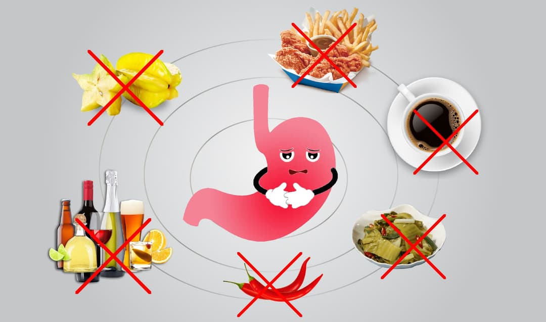 Hẹp môn vị: Nguyên nhân, dấu hiệu và cách xử trí