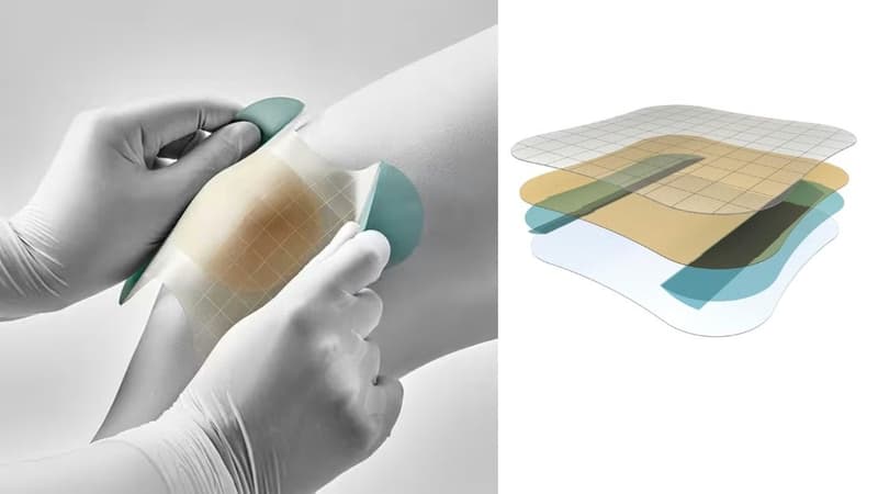 Công dụng và cách dùng băng dán hydrocolloid trong y tế và chăm sóc da