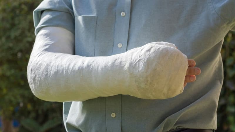 Kỹ thuật bó bột Desault và những lưu ý chăm sóc giúp phục hồi chấn thương vai