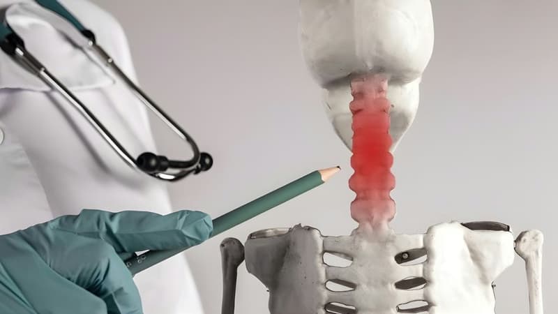 Các cách điều trị thoát vị đĩa đệm cột sống cổ và những lưu ý