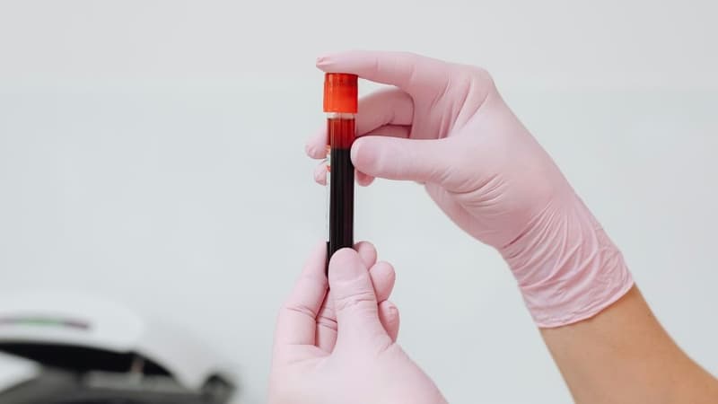 Kết quả xét nghiệm HIV âm tính có chắc chắn không nhiễm virus không