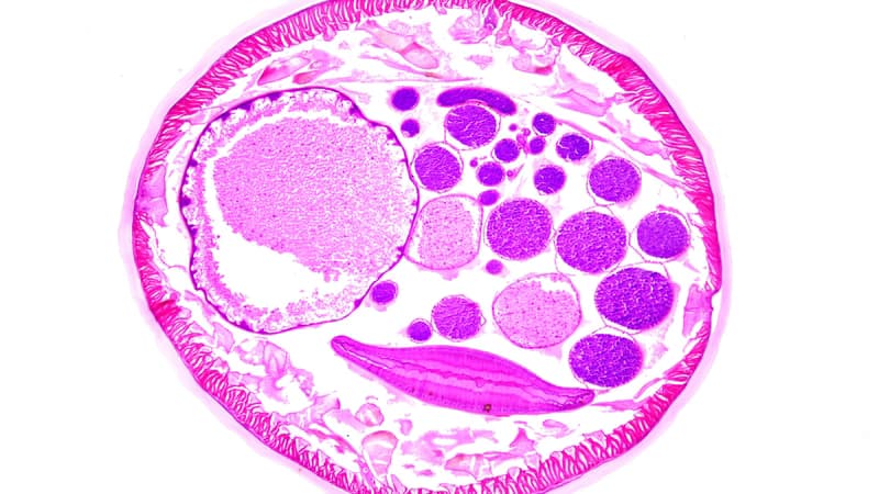 Nhiễm trùng roi Trichomonas có nguy hiểm không và cách phòng ngừa