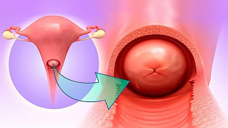 Đặc điểm nhận diện hình ảnh nội soi cổ tử cung bình thường và bất thường
