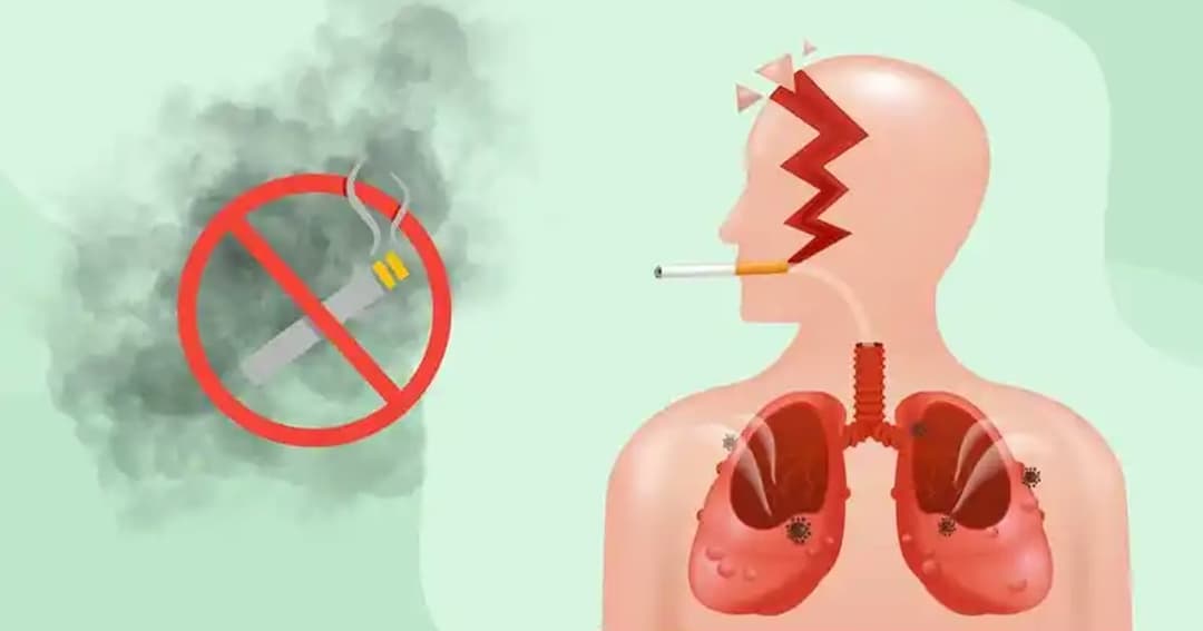 Tác hại của thuốc lá đối với sức khỏe và lý do nên cai thuốc sớm