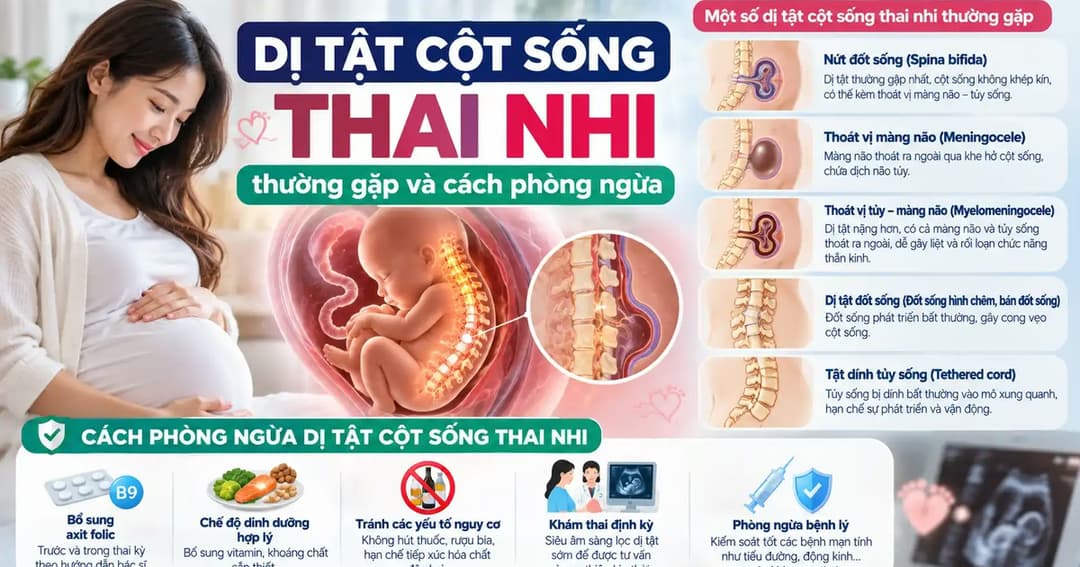 Dị tật cột sống thai nhi thường gặp và cách phòng ngừa