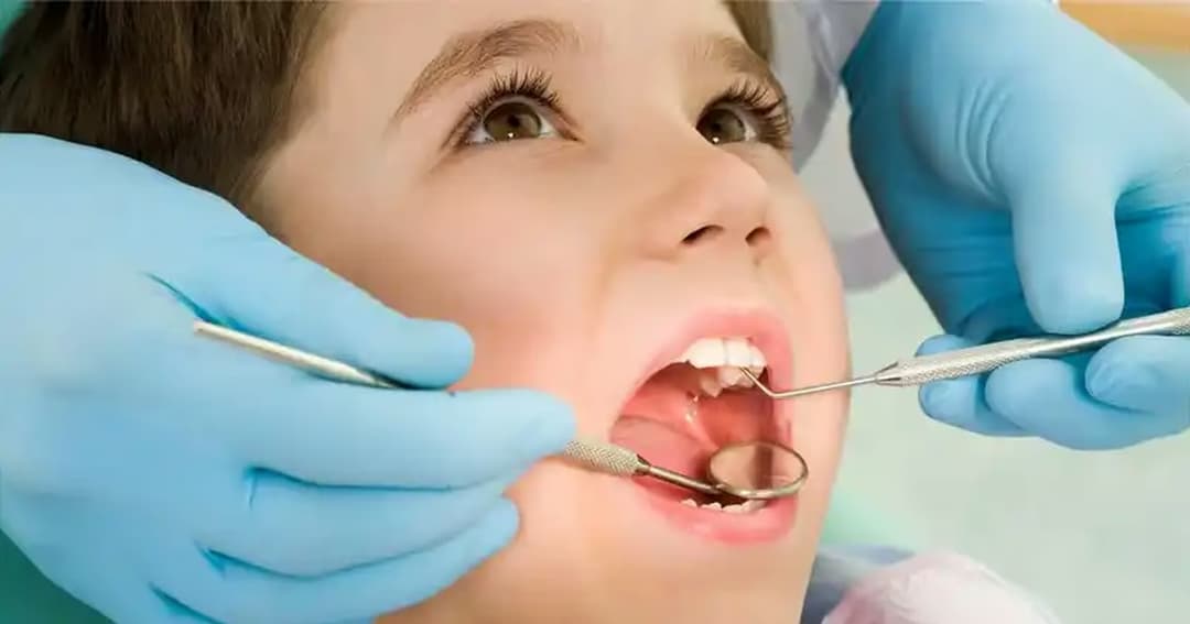 Nên khám răng định kỳ bao lâu một lần và ý nghĩa đối với sức khỏe