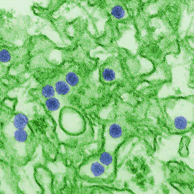 Bệnh do virus Zika: Dấu hiệu, đường lây truyền và cách phòng ngừa