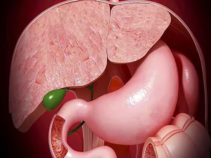 Polyp túi mật: Dấu hiệu, mức độ nguy hiểm và cách xử trí