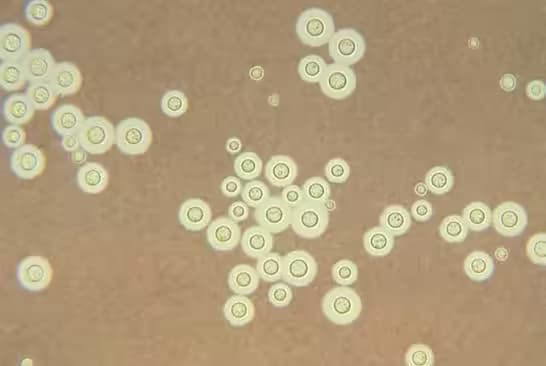 Nhiễm Cryptococcus: Nguyên nhân, dấu hiệu và cách điều trị