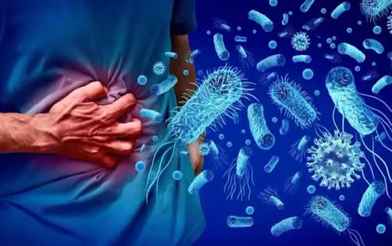 Nhiễm khuẩn Listeria: Nguyên nhân, dấu hiệu và cách xử trí