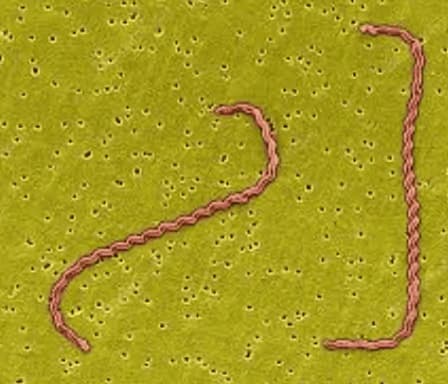 Nhiễm Leptospira: Nguyên nhân, dấu hiệu và các biện pháp phòng bệnh