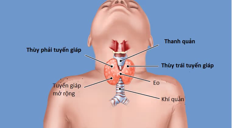 Cường giáp: Nguyên nhân, dấu hiệu, chẩn đoán và cách xử trí