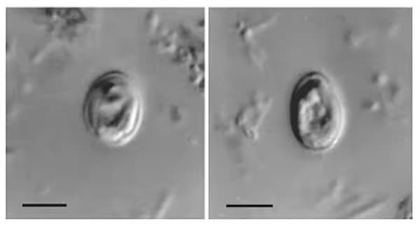 Bệnh do Cryptosporidium: Nguyên nhân, triệu chứng và cách xử trí