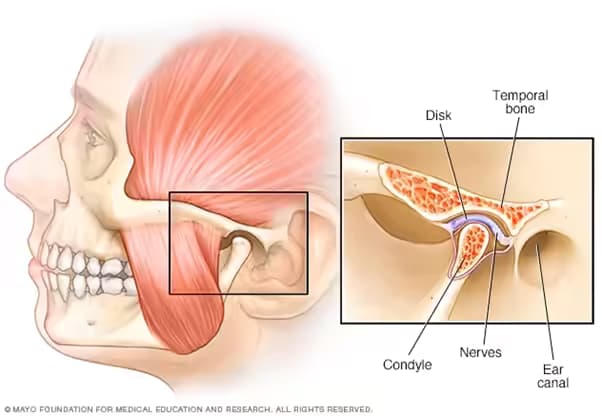 Rối loạn khớp thái dương hàm: Nguyên nhân, triệu chứng và cách điều trị