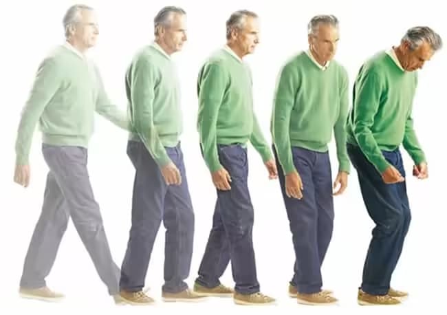Rối loạn vận động: Nguyên nhân, dấu hiệu và cách điều trị