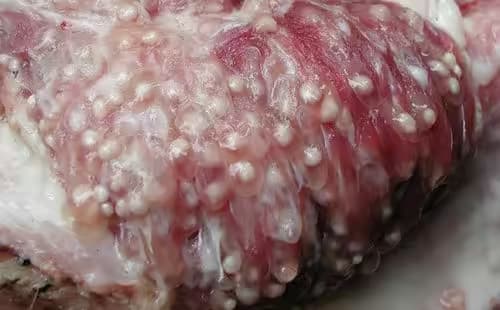 Bệnh sán lợn gạo: Nguyên nhân, triệu chứng, mức độ nguy hiểm và cách điều trị