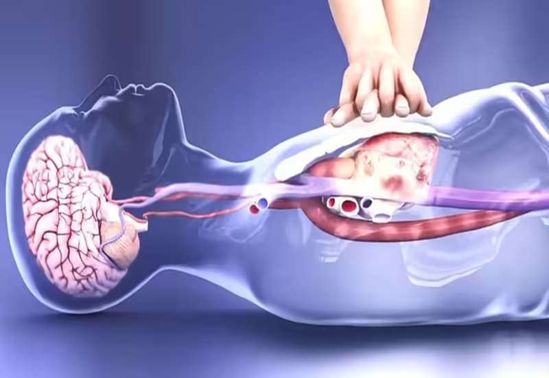 Sốc tuần hoàn: Nguyên nhân, dấu hiệu và cách xử trí y tế kịp thời