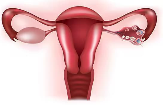 Suy buồng trứng: Nguyên nhân, dấu hiệu và cách điều trị