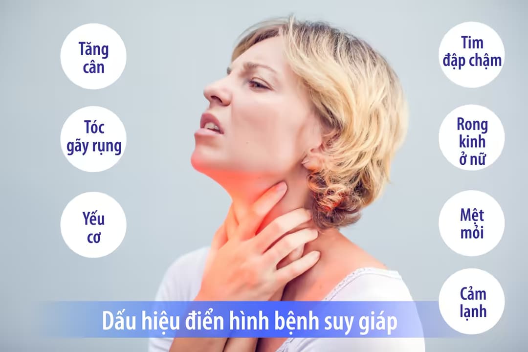 Bệnh suy giáp: Nguyên nhân, dấu hiệu và cách điều trị