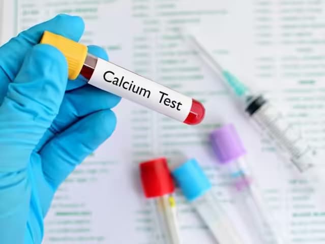 Tăng canxi máu: Nguyên nhân, dấu hiệu và cách điều trị