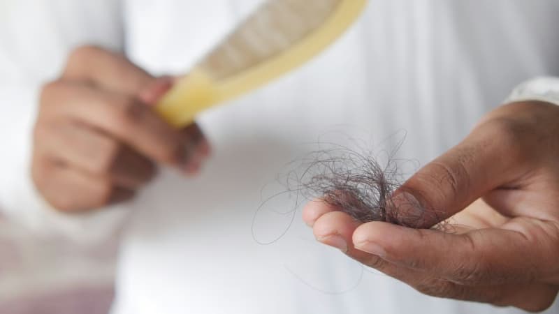 Tóc rụng không thấy chân tóc có nguy hiểm không và cách xử lý